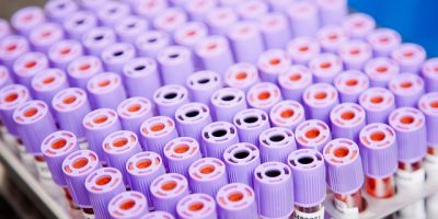 laboratory-3496713_640